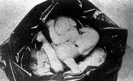 Εκτρωμένα παιδιά στα σκουπίδια νοσοκομείου